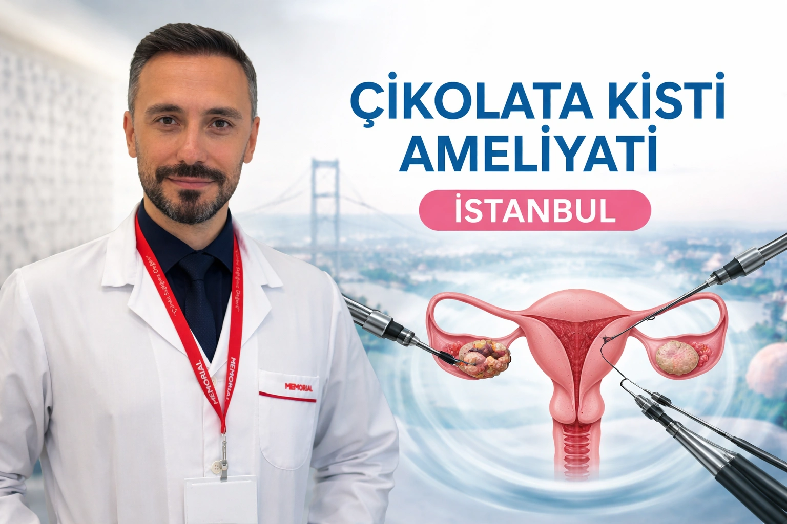 Çikolata kisti ameliyatı İstanbul