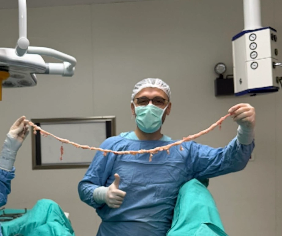 Miyom ameliyatı İstanbul